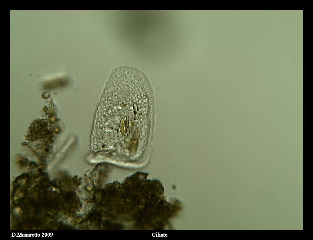 Ciliato con diatomee  [ Chilodonella sp.]